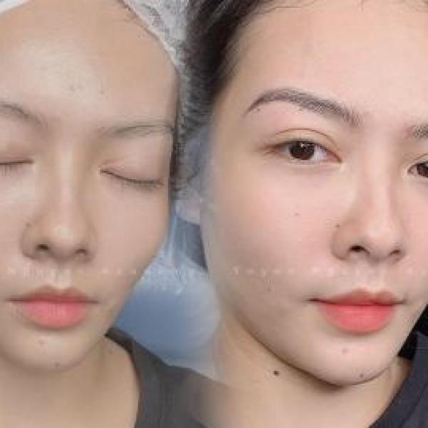   
          Reakbrows is the greatest choice 
